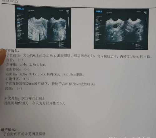 怎么样容易怀孕的几率高一点？做完之后怎么样容易怀孕-第1张图片-