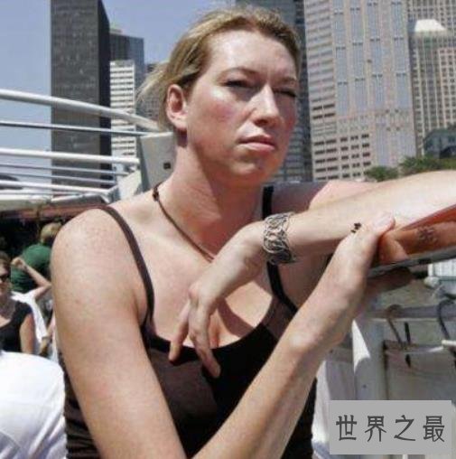 世界十大最高的女性排行榜，最高的女人只活了十七年