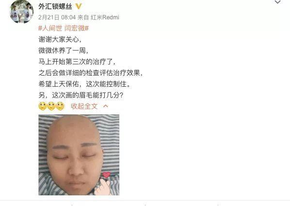 《人间世2》大结局：很遗憾，“最美”抗癌女博士还是走了